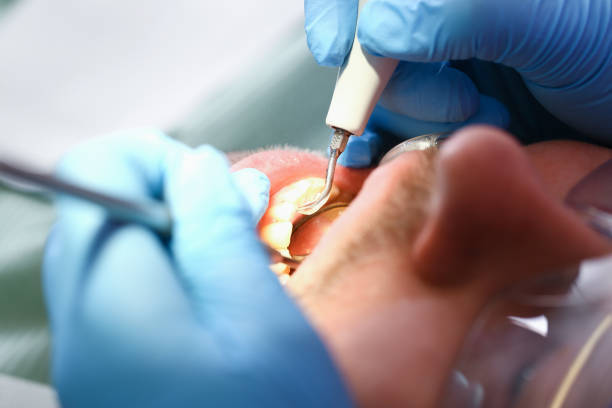 Best Orthodontic Emergency Dentist in Mill Hall, PA