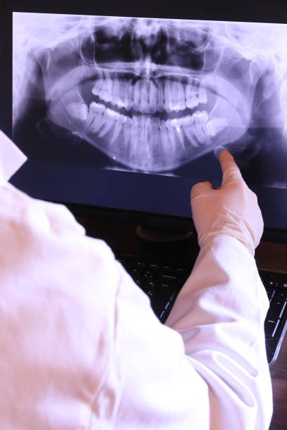 Best Emergency Dentist for Knocked-Out Tooth in Mill Hall, PA
